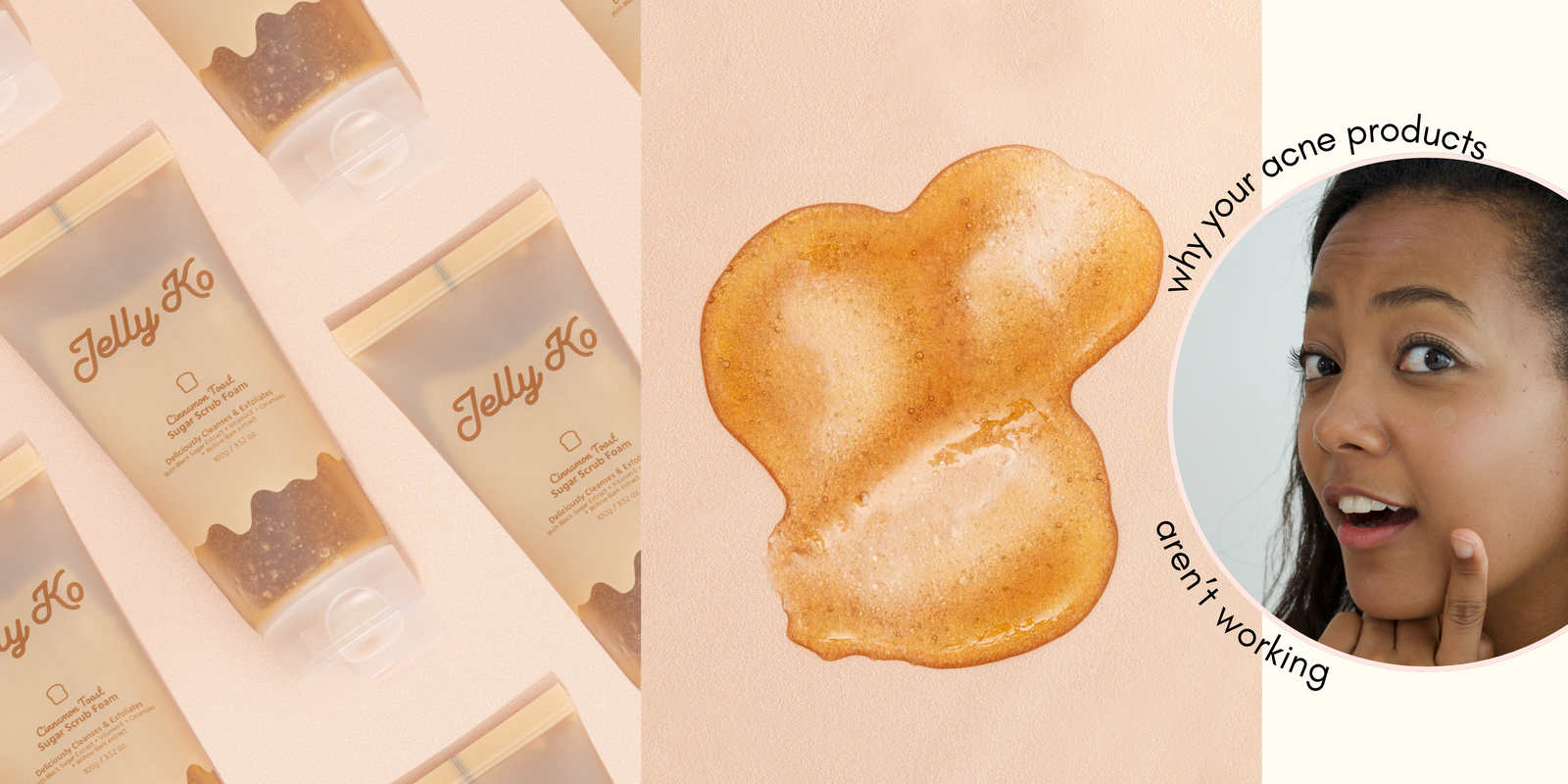 6 Reasons Why Your Acne Products Aren’t Working