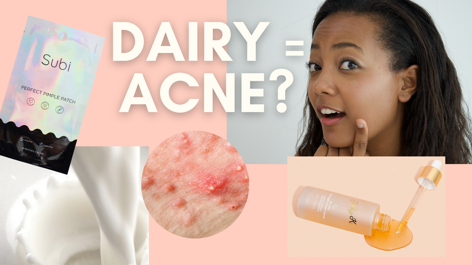 Does Dairy Cause Acne?