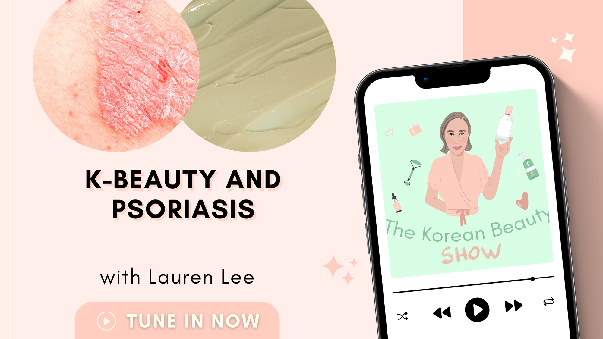 Kbeauty for Psoriasis