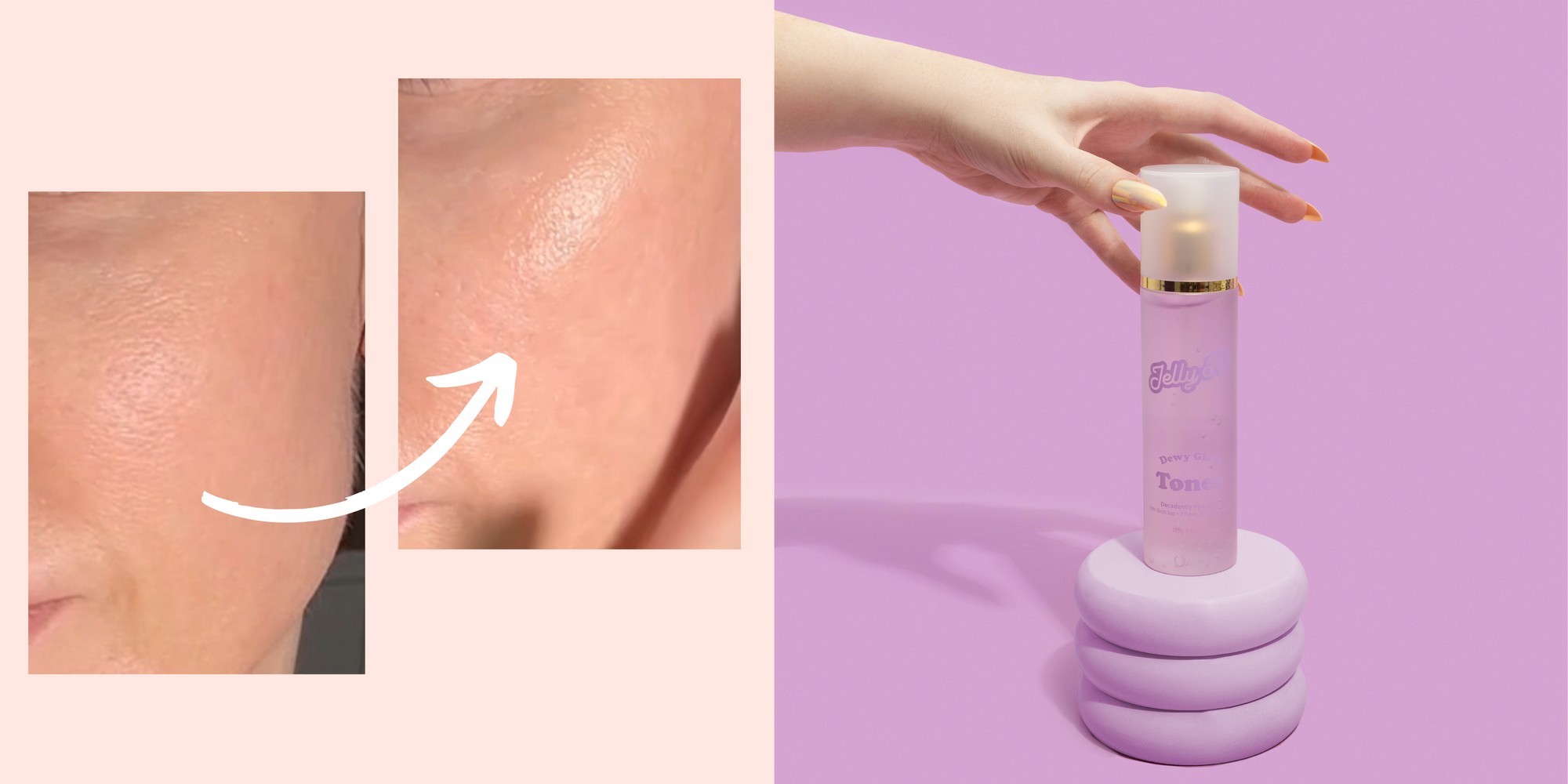 Korean Skincare For Combination Skin