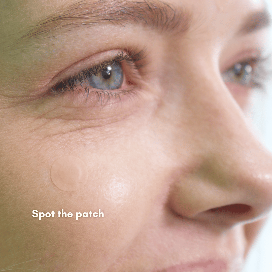 jelly ko pimple patches