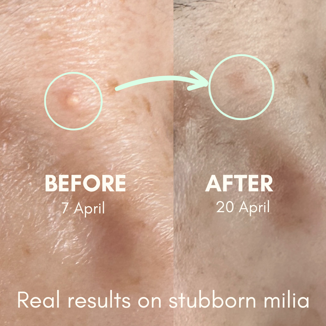 Before & After Using Be Jelly Serum