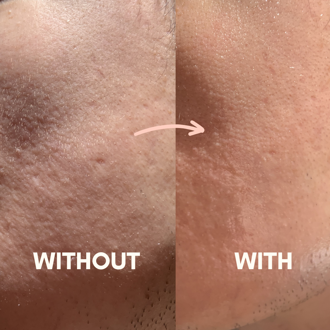 Cherry Blossom Sleeping Mask Before and After