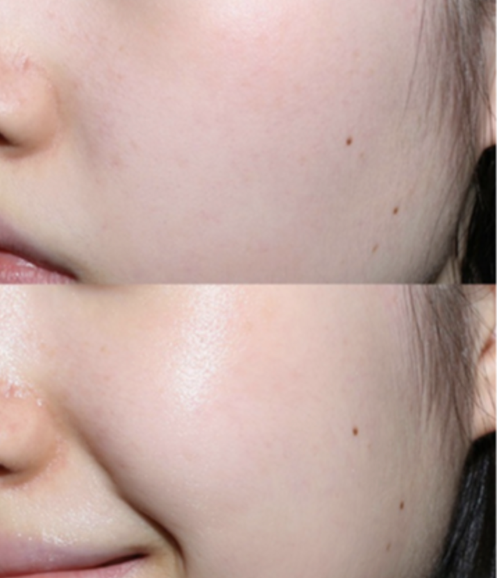 COSRX The Hyaluronic Acid 3 Serum