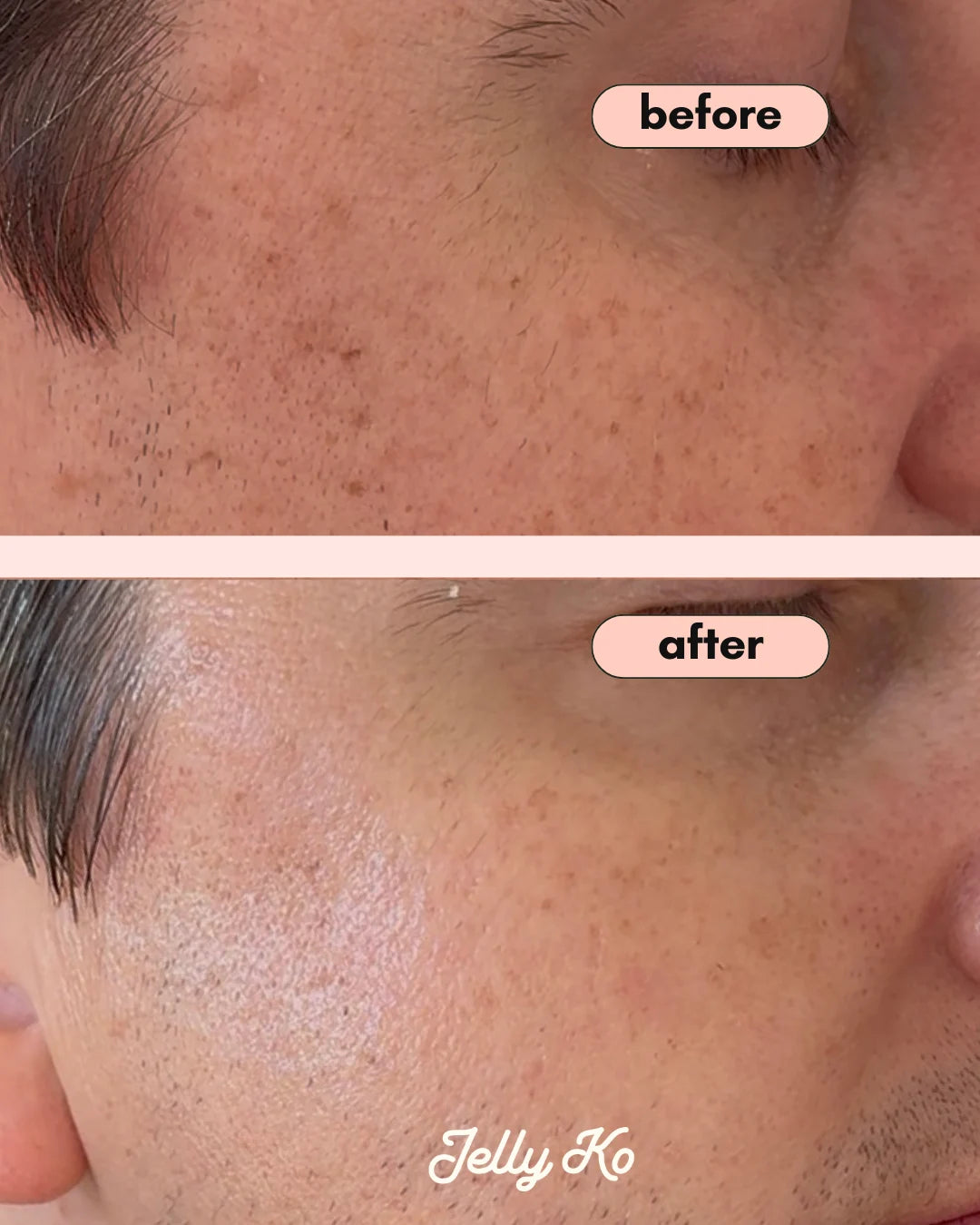 Jelly Ko White Truffle Soufflé Serum