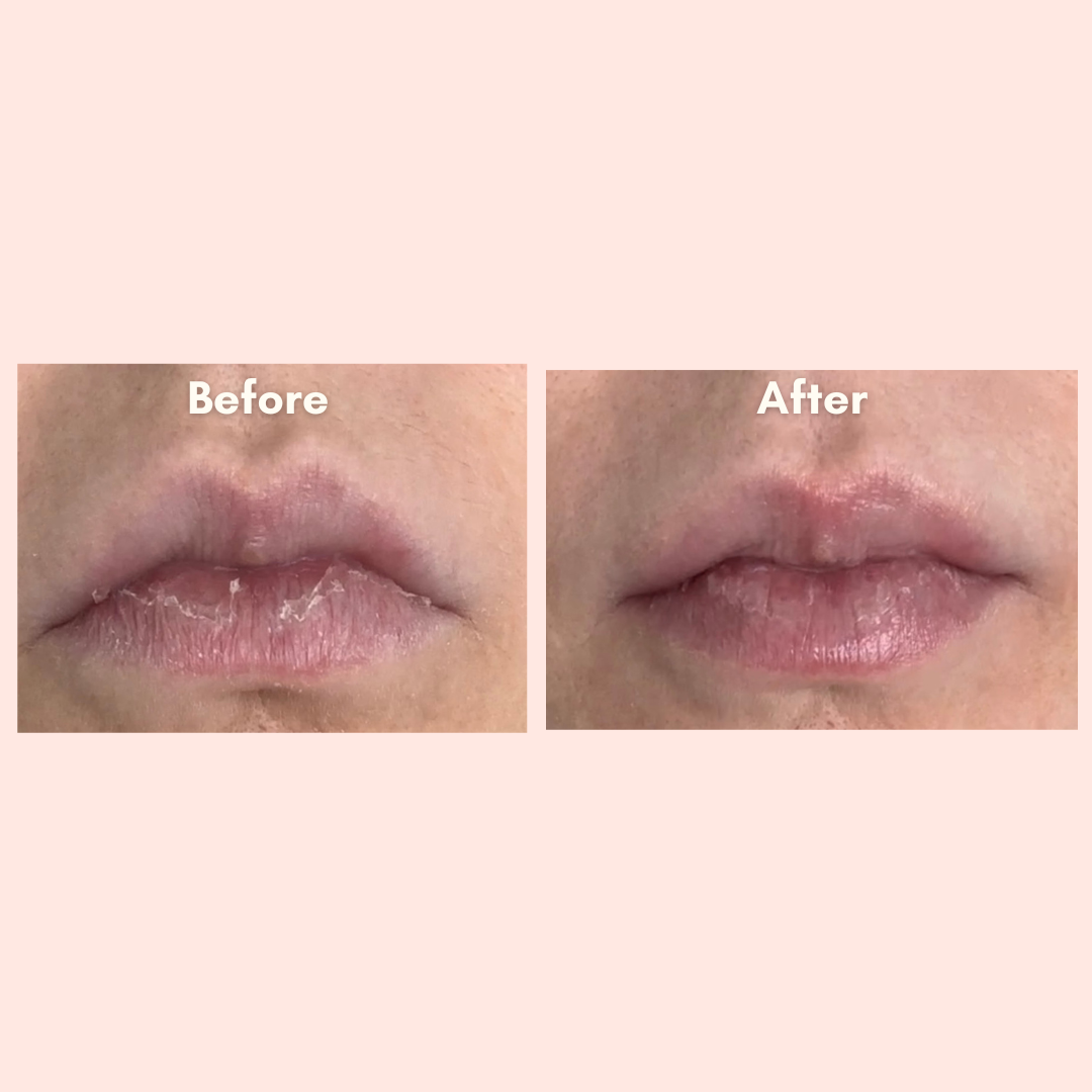 Jelly Ko Cinnamon Toast Sugar Scrub Foam Before and After