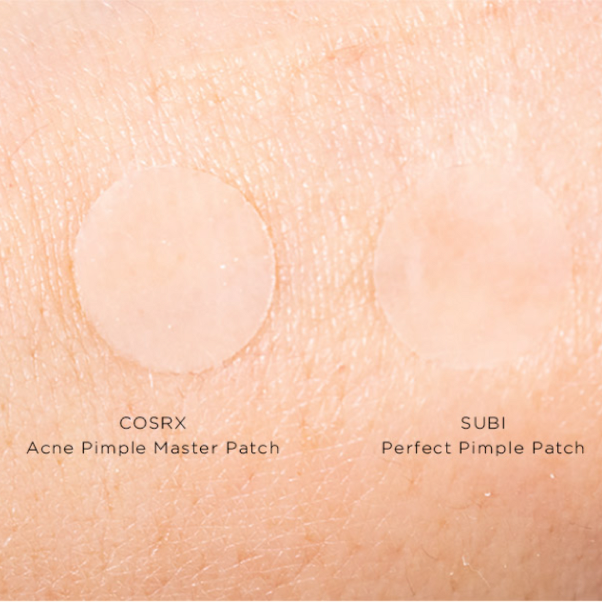 Subi Pimple Patches vs COSRX Acne Patches