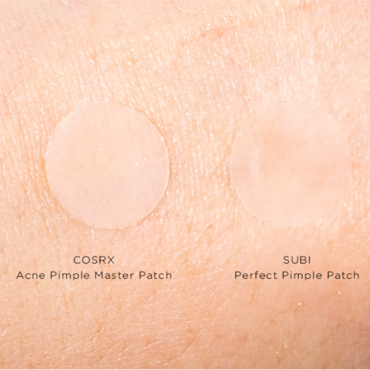 Subi Pimple Patches vs COSRX Acne Patches