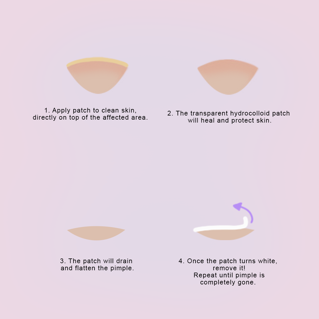 Subi Perfect Pimple Patch